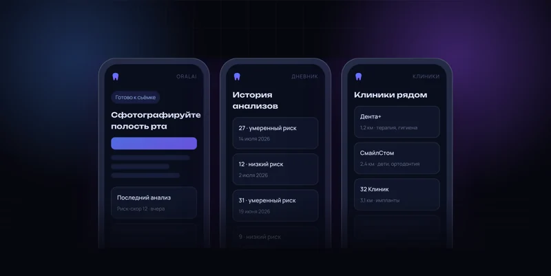 AI-приложение для диагностики здоровья полости рта «OralAI»